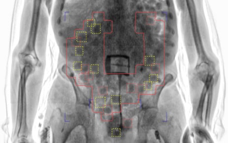 Over 20,000 attempts to smuggle contraband thwarted by X-ray body scanners