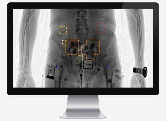 SecurPass allows for full body cavity imaging