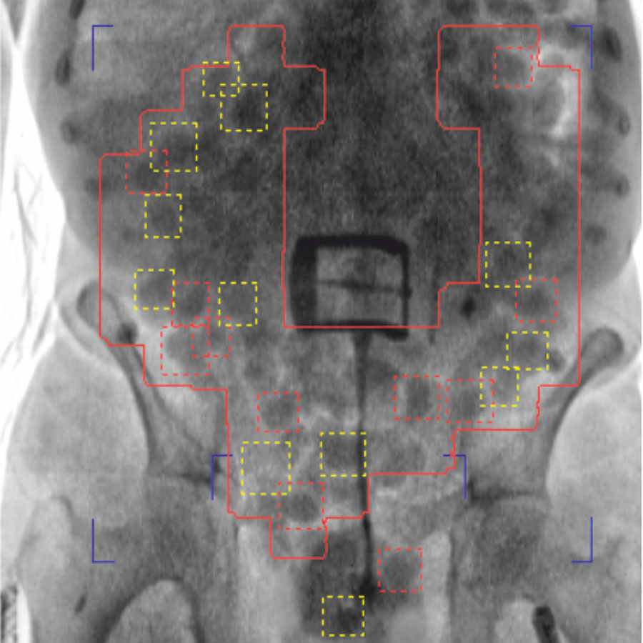 Visualisation and detection