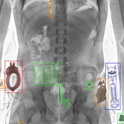 LINEV Systems bodyscanner AI software image