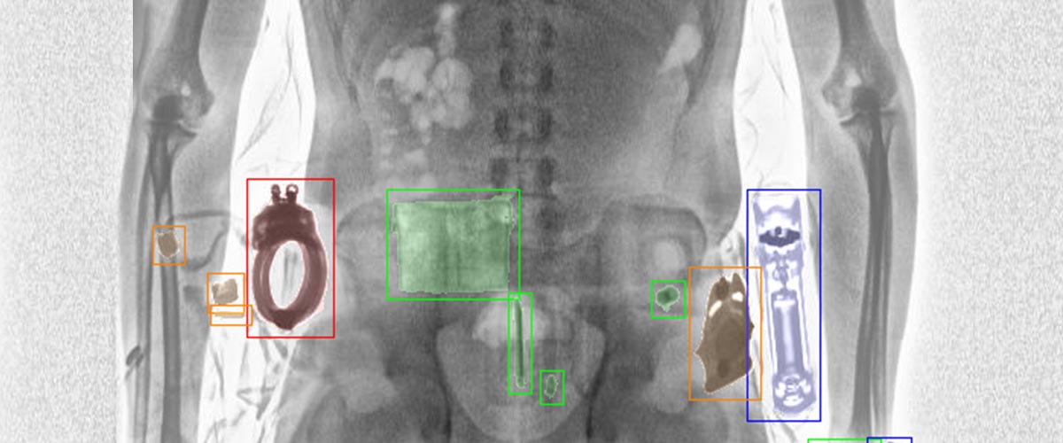 LINEV Systems bodyscanner AI software image