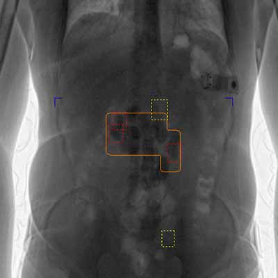 LINEV Systems bodyscanner DRUGUARD image