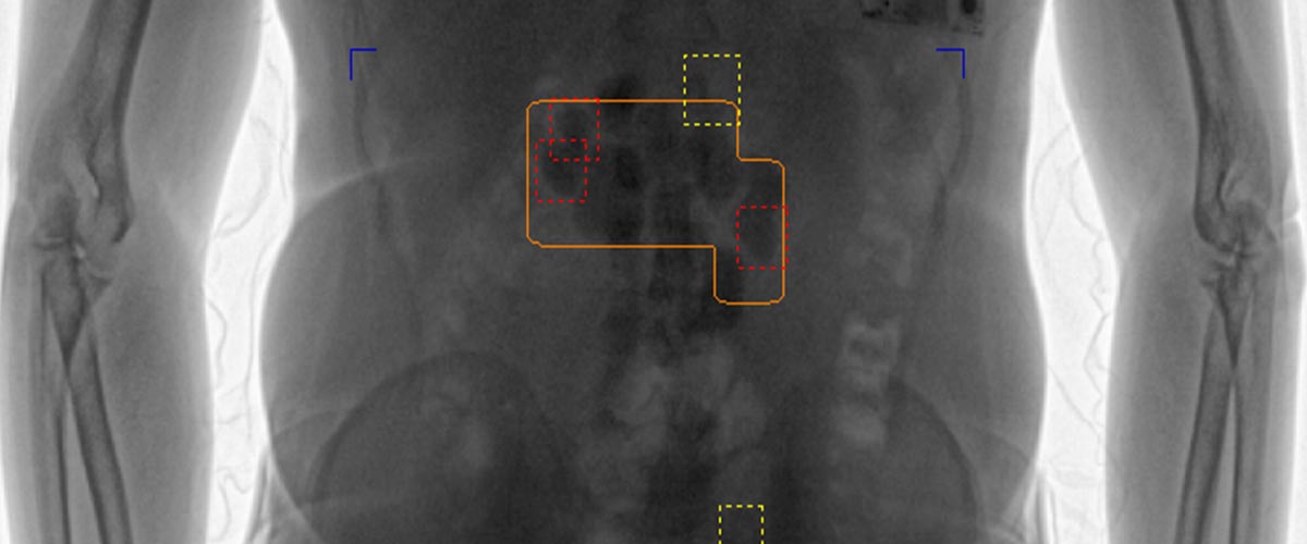 LINEV Systems bodyscanner DRUGUARD image