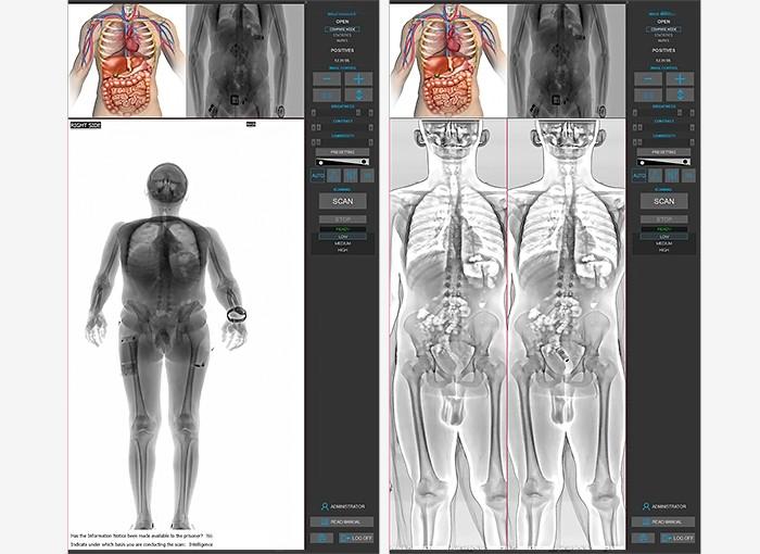 Airport Security Scanners Drugs