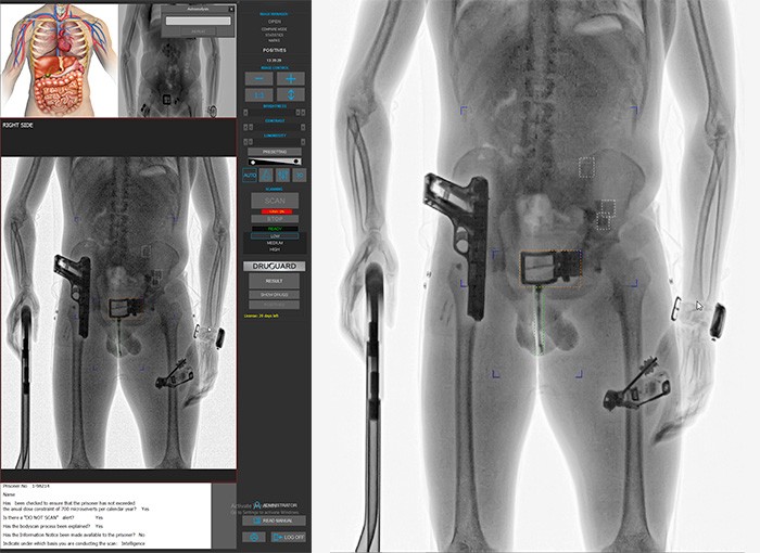 SecurPass allows for full body cavity imaging