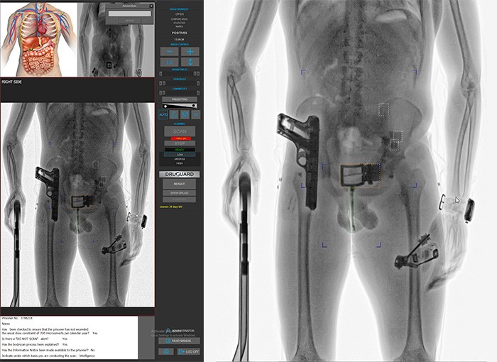 CONPASS SMART DV · Prison security solution: x-ray full body