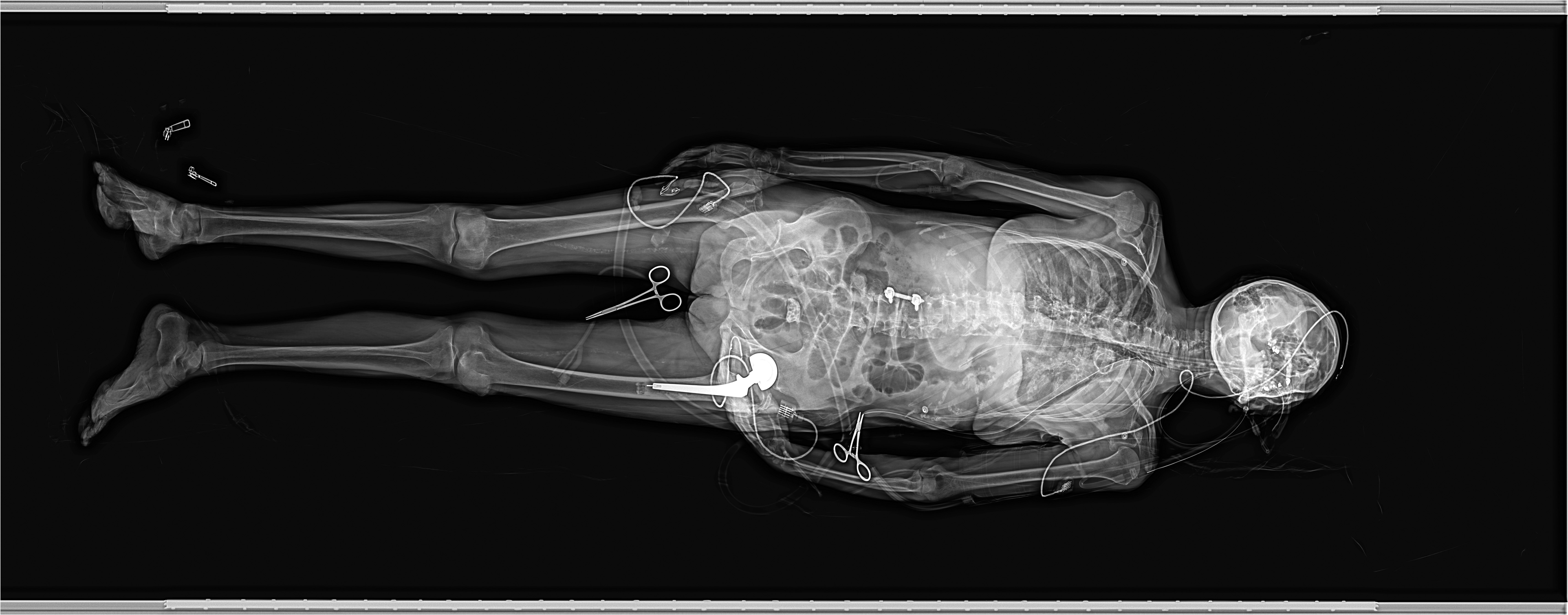 Forensic Imaging